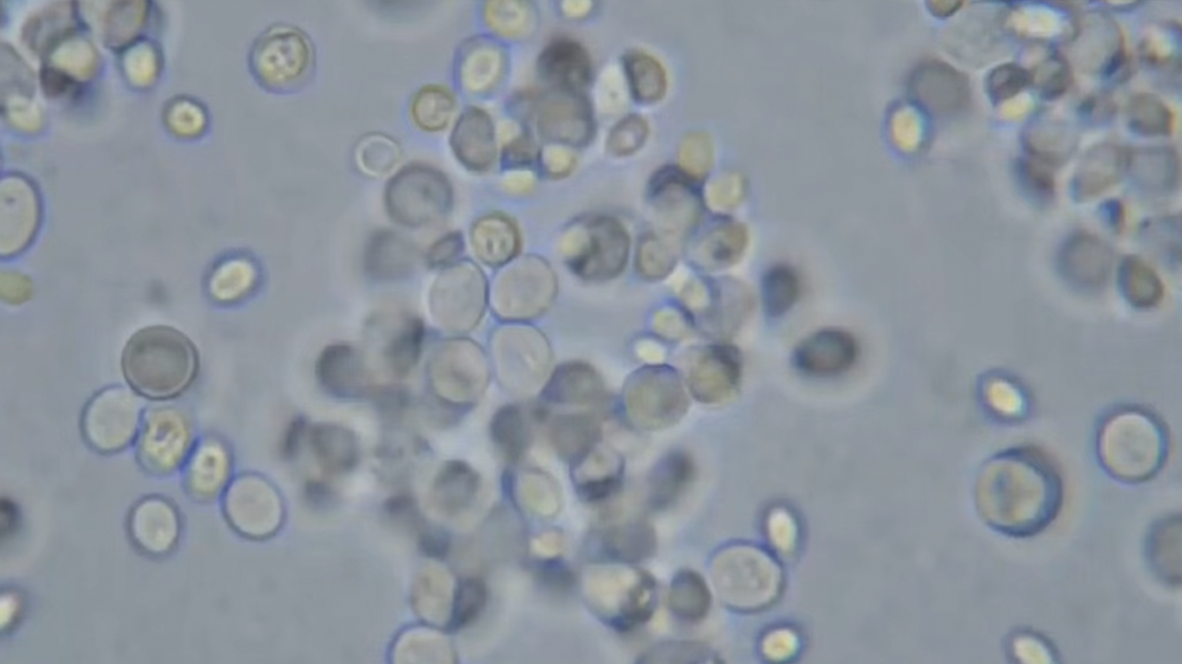 The image shows an extreme close-up of numerous tiny, circular, transparent or semi-transparent bubbles or cells clustered together against a blurred background.