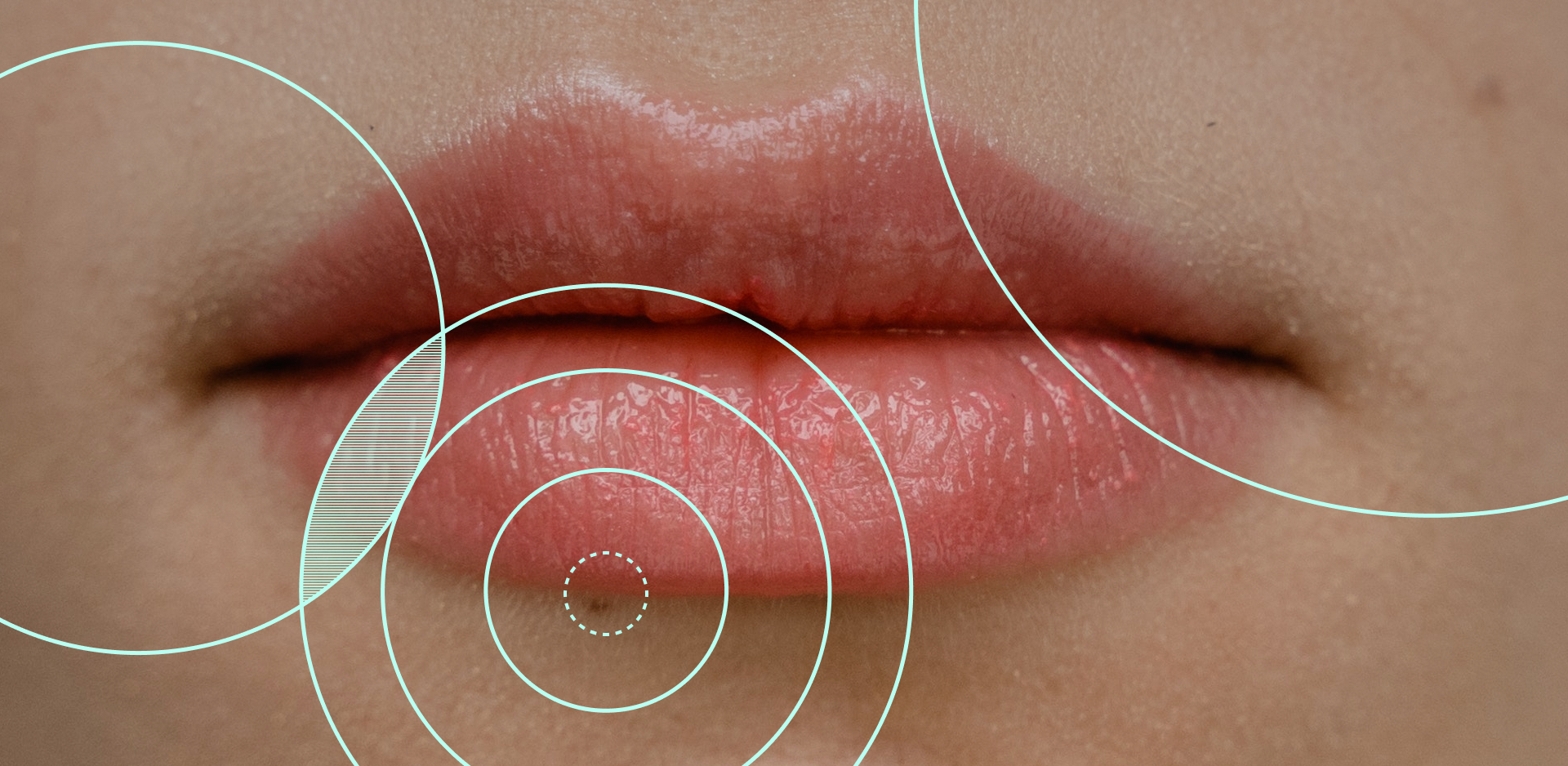 Image of lips overlaid with ripple design.