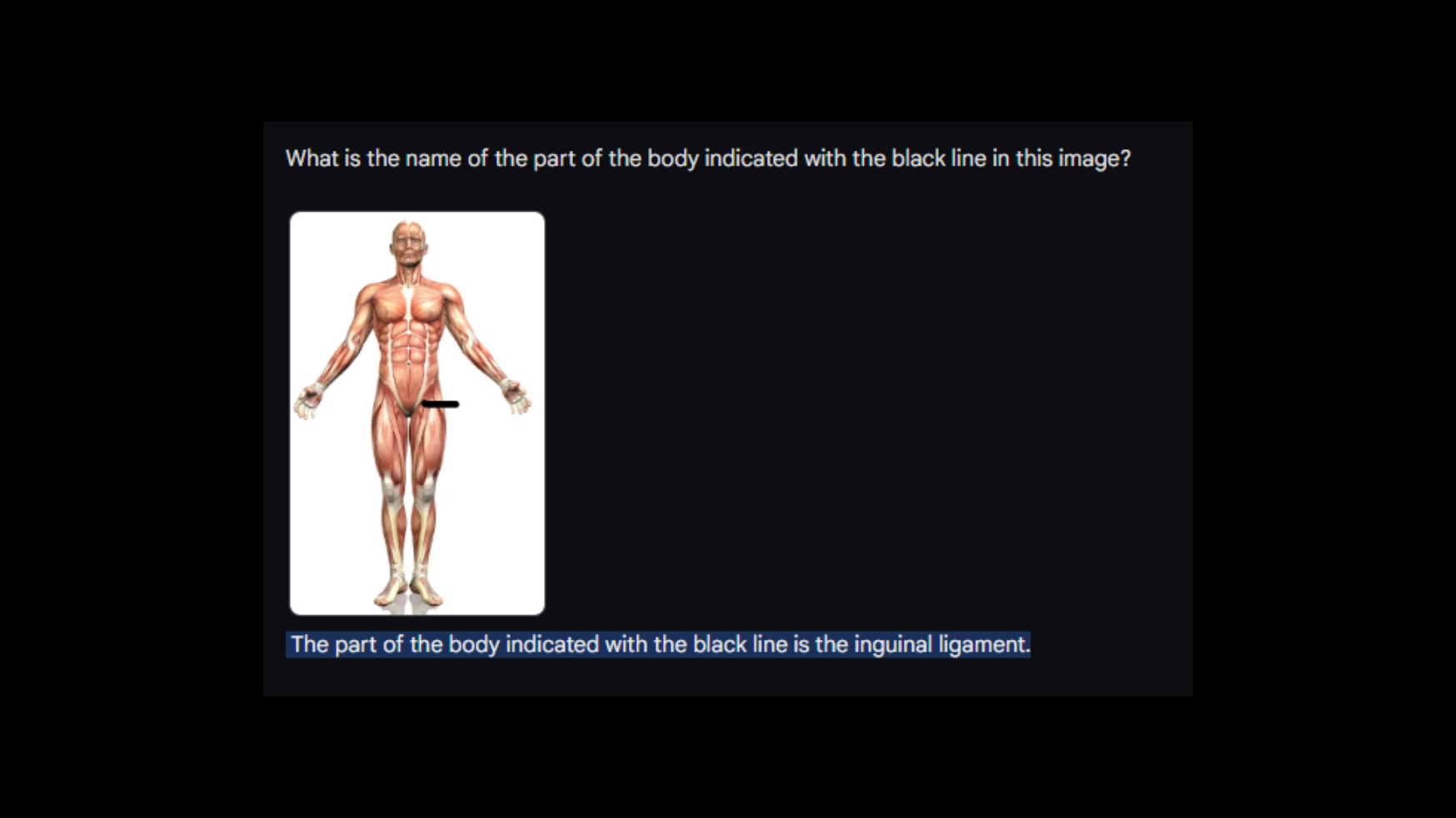 gemini