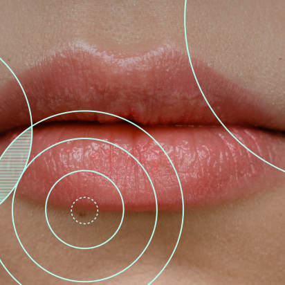 Image of lips overlaid with ripple design.